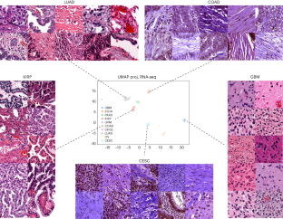 Olivier Gevaert: “Generation of synthetic whole-slide image tiles of tumours from RNA-sequencing data via cascaded diffusion models” published in Nature Biomedical Engineering