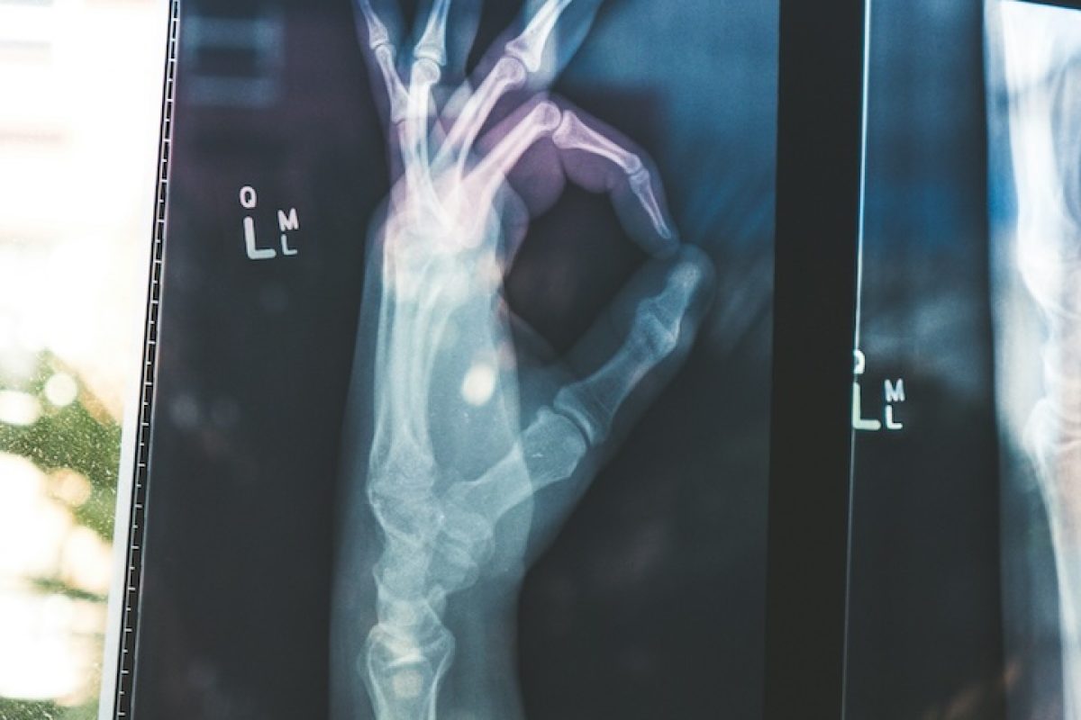 photo of an xray