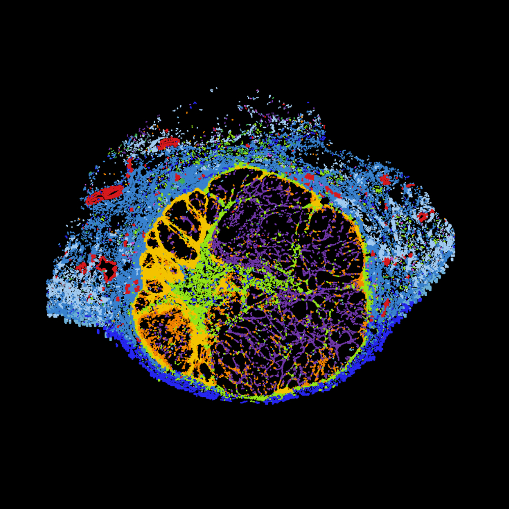 A blood test reveals ‘neighborhoods’ of cells in tumors, predicts immunotherapy responses